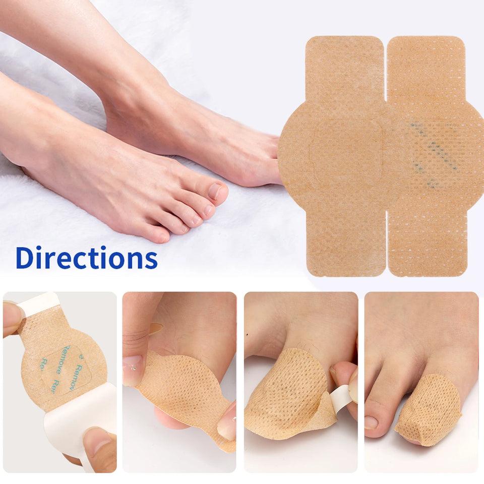 21pcs Waterproof Nail Fungus Patch Toenail Repair Sticker Anti Infection Ingrown Toenail Correction Foot Care