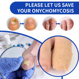 21pcs Waterproof Nail Fungus Patch Toenail Repair Sticker Anti Infection Ingrown Toenail Correction Foot Care