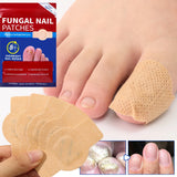 21pcs Waterproof Nail Fungus Patch Toenail Repair Sticker Anti Infection Ingrown Toenail Correction Foot Care